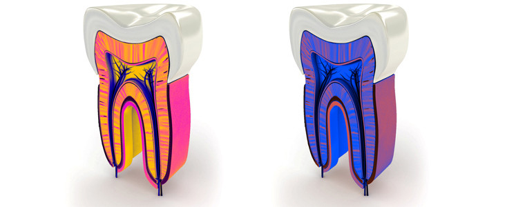 Zahn-Wurzel Querschnitt