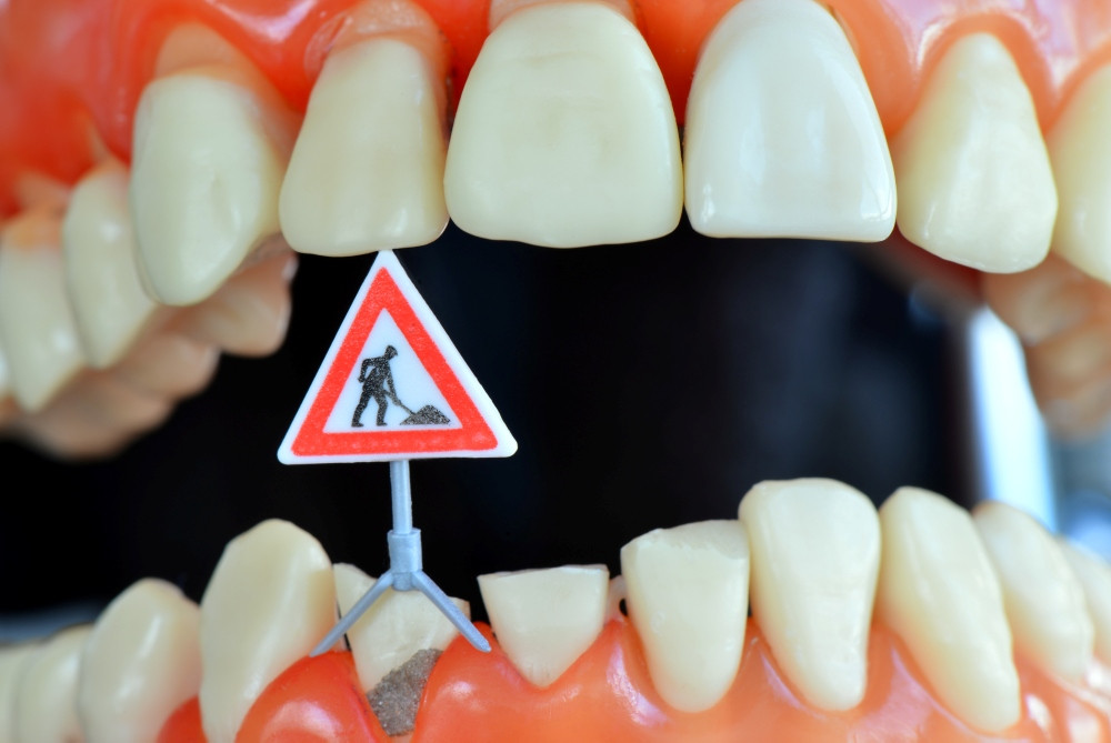 Bild Testnewsletter "Bauarbeiten am Zahn"