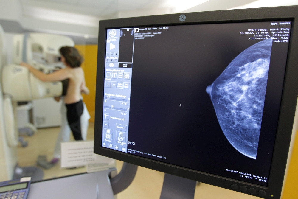 Mammografie: Die Screening-Programme unterscheiden sich von Land zu Land.