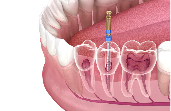 Dentists4Dentists/Berufsausübung/Wie Roboter in Zukunft Zahnärzte und Patienten unterstützen könnten