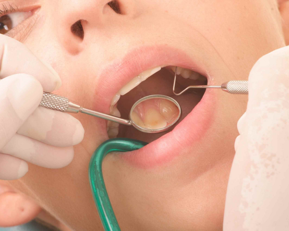 Welche Auswirkungen haben Zahnfehlstellungen auf Zahnfleischerkrankungen? Dieser Frage gingen Greifswalder Wissenschaftler mit teils überraschenden Ergebnissen nach.
