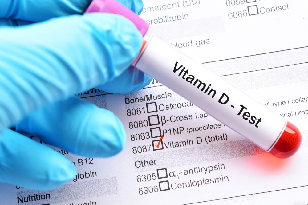 Blutprobe im Röhrchen mit Aufschrift Vitamin D