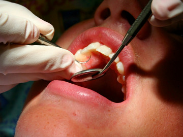 Frau beim Zahnarzt