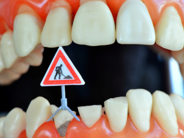Bild Testnewsletter "Bauarbeiten am Zahn"