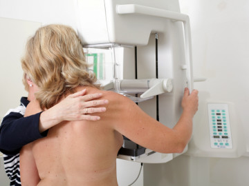 Frau bei der Mammographie