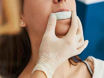Frau beim Zahnarzt, bei der ein Gebissabdruck genommen wird.