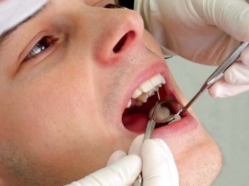 Mann beim Zahnarzt